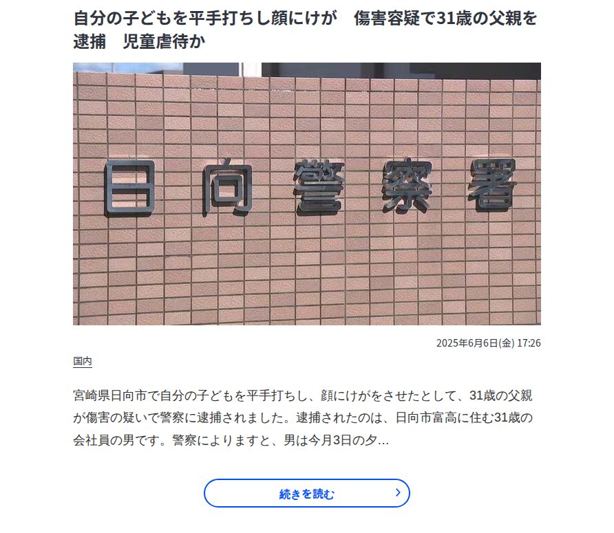自分の子どもを平手打ちし顔にけが 傷害容疑で31歳の父親を逮捕 児童虐待か | MRTニュース | MRT宮崎放送 - 保存されたスクリーンショット